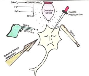 Factors Contributing to degeneration of nigrostriatal depaminergic neurone causing parkinsonism